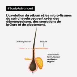 Traitement Apaisant Intense Scalp Advanced L'Oréal Professionnel 200ML -Hair Care Soldes traitement apaisant intense scalp advanced l oreal professionnel 200ml 5